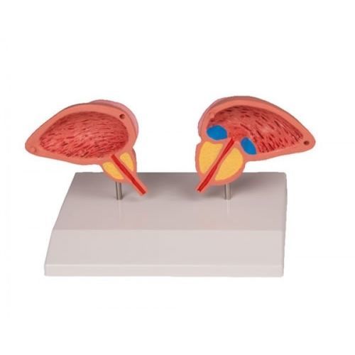 膀胱の解剖模型 - ZKJ-166-M - Educational + Scientific Products Ltd - 尿道の / 尿道 / 前立腺の