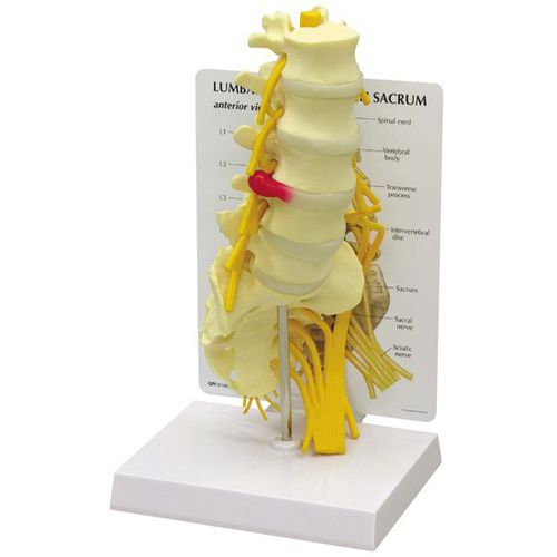 腰椎の解剖模型 - 1700 - GPI Anatomicals - 実習用