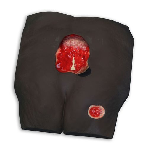 骨の解剖模型 - Stan™  - VATA, Inc. - 腰椎-仙椎の / 肌の / 褥瘡処置