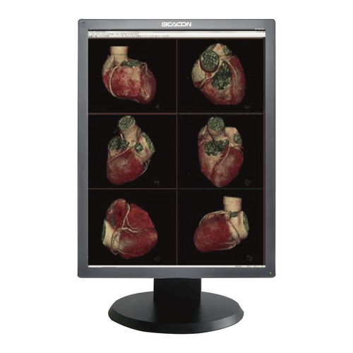 医療用モニター - C310S - Shenzhen Beacon Display Technology - 医用画像用 / 診断用 / 高解像度