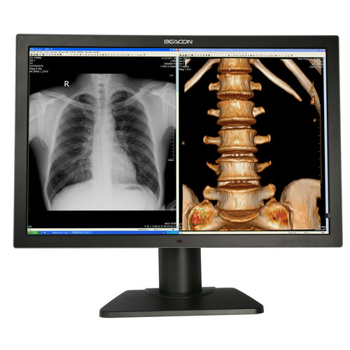 診断用モニター - C82W+ - Shenzhen Beacon Display Technology - フルHD / 3840 × 2160 / 31.5インチ