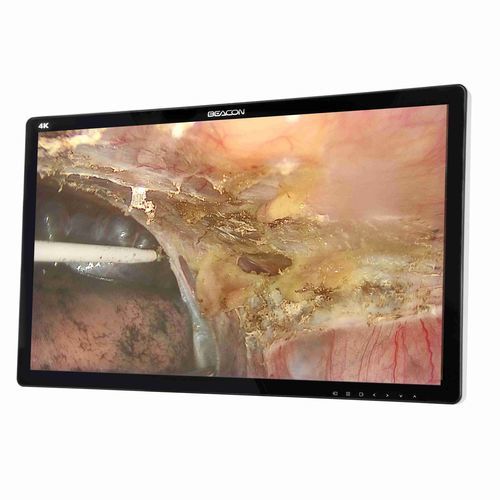 医療用モニター - S2785P - Shenzhen Beacon Display Technology - 外科用 / 4K解像度 / 27インチ