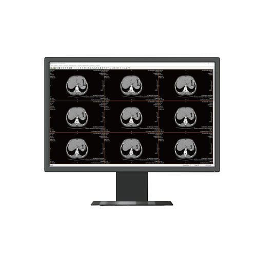 医療用モニター - HL2316SHTB  - Shenzhen Beacon Display Technology - 1920 x 1080 / 23.8インチ / LEDバックライト