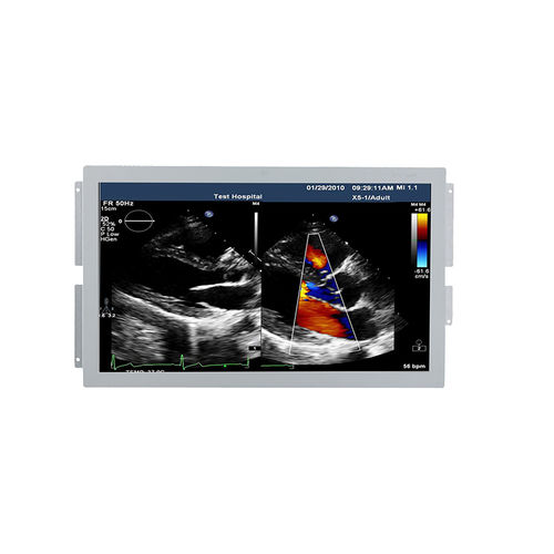 医療用モニター - U238W - Shenzhen Beacon Display Technology - 超音波画像診断用 / 1920 x 1080 / 23.8インチ