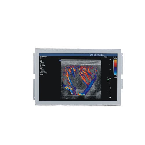 医療用モニター - U156W - Shenzhen Beacon Display Technology - 超音波画像診断用 / 1920 x 1080 / 15.6インチ