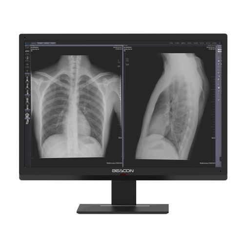 高解像度モニター - C616W - Shenzhen Beacon Display Technology - 30" / 高輝度 / ディスプレイ ポート
