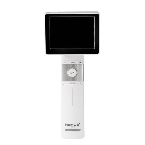 超高解像度ビデオ耳鏡 - DSC300 - Medimaging Integrated Solution - ビデオモニター搭載 / USB接続付き