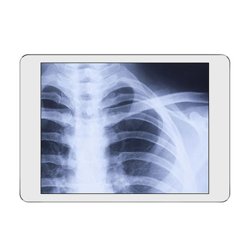 X線撮影用医療用画像取得システム - iRay DR - iRay Technology - 携帯型