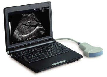 携帯型超音波装置 -  LEO-3000D1  - Xuzhou Leo Medical Equipments - 多目的超音波画像診断用 / 白黒