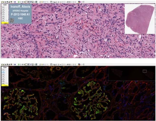 イメージ分析ソフト - Aperio ImageScope - Leica Biosystems/ライカ - 医療用 / 病理組織実験用