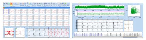 分析ソフト - CardioTrak  - Beneware Medical Equipment - ホルター心電図用 / 医療用
