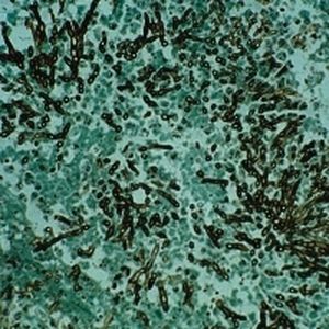 染色液試薬 - Grocott MW   - BIO-OPTICA Milano - 細胞学 / 組織学用