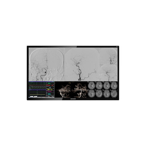 手術室用モニター - E550EG - Nanjing Jusha Display Technology - 内視鏡用 / 3840 × 2160 / リモート