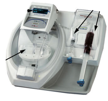 セラピーアフェレーシス装置 - MAGELLAN® - Isto Biologics - 血栓アフェレーシス用