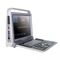 携帯型超音波装置P60Xuzhou Ruisheng Chaoying Electronic Technology