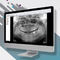 可視化ソフトOMSCarestream Dental