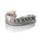 VarseoSmile&reg; TriniQ&reg;BEGO