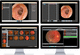 医療訓練用ソフト / 医療用画像インポート / シミュレーション / 病院用