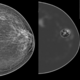 分析ソフト / 診断用 / データ収集 / 乳がん検査用