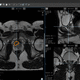 前立腺がん検診用ソフト / 医療用 / PACS（画像保管通信システム）用 / 管理用
