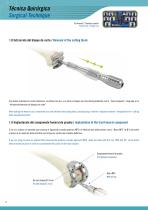 DCF SURGICAL TECHNIQUE (FEMORAL) GENUTECH - 12