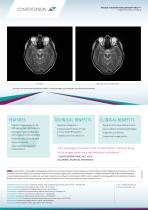 GOPView MRI2-2