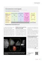 DIEurope Breast CT Leiden-4