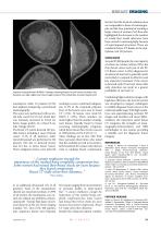DIEurope Feb/Mar 20: Spiral Breast CT: an innovative technology for high resolution real 3D breast imaging without compression-3