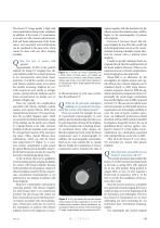 DIEurope Jun 21: Breast CT in women with breast implants - 2