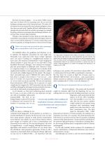DIEurope Nov 20: Breast CT - a ground-breaking innovation - 2