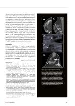 Spiral Breast CT: Going Further with Photon Counting (Source: DIEurope)-4