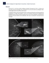 Artificial Intelligence for Digital Breast Tomosynthesis - 2