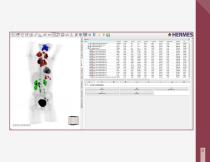 Lymphoma PET-CT Tumor Finder?-4