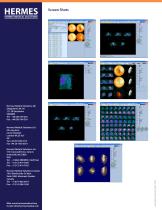 Quantitative Perfusion SPECT (QPS)-3