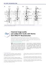SUV SPECT Reconstruction-2