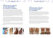 Modus Focused ESWT Dermatologie-9
