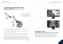 Spark® ESWL Lithotripsy System - 6