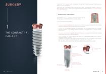 IMPLANT Kontact ™ Perio Level-3