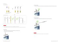 Atraumatic Extraction Kit - 4