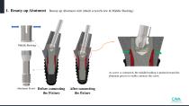 Beauty-up™ Abutment-5