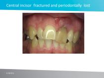 Case study No 2 - 2