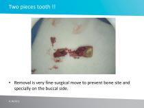 Case study No 2 - 5