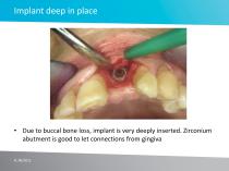 Case study No 3 - 3