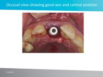 Case study No 4 - 11