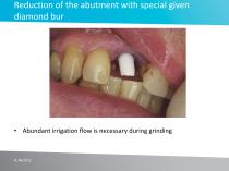 Case study No 4 - 12
