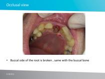 Case study No 4 - 5