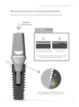 dental implant system-9