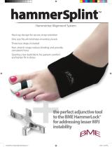 HammerSplint?-1