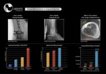 CarboFix Distal Femur Plates - 3