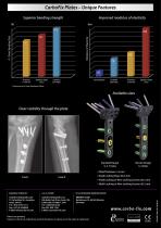 CarboFix Distal Radius Plate - 2